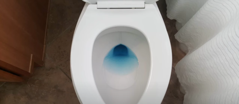 WHy is my toilet water low